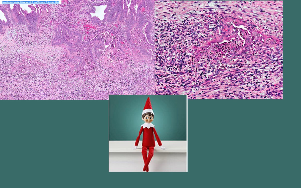 “You’ve heard of elf on the shelf, but what about…”
#gynpath #pathtwitter