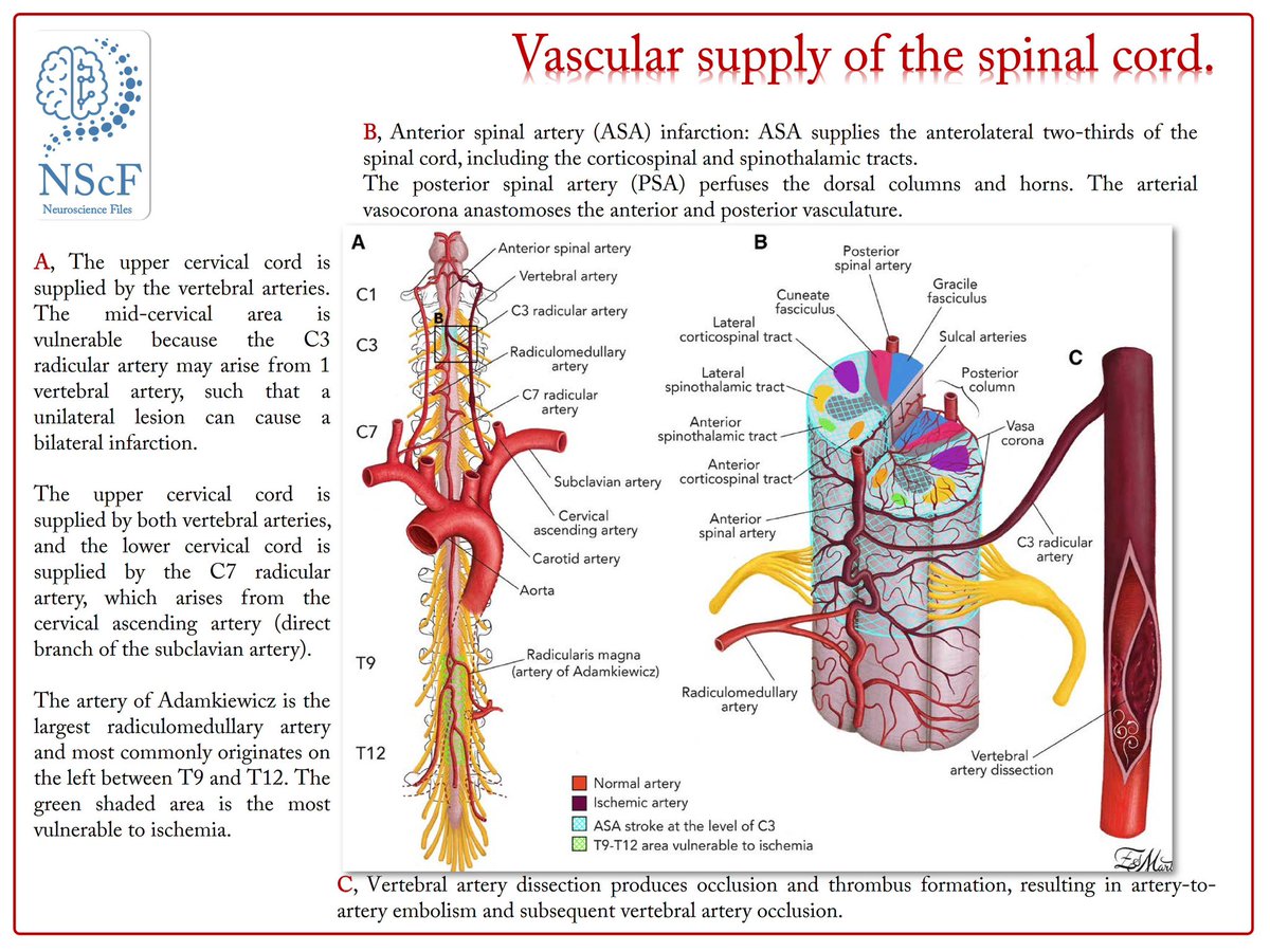 The National Spinal Injuries Centre (@nsicstokemand) on Twitter photo Vascular supply of the spinal cord explained @Rehab_Conf <a href="/sci_qol/">إصابات الحبل الشوكي</a> <a href="/SaudiSCI/">اصابات الحبل الشوكي</a> @Rehab_Conf <a href="/WiDdQgYKv9gka32/">مصابى الحبل الشوكى</a> <a href="/sci_qol/">إصابات الحبل الشوكي</a> <a href="/SaudiSCI/">اصابات الحبل الشوكي</a> <a href="/ICORD_SCI/">ICORD</a> <a href="/APTA_SCISIG/">APTA_SCISIG</a> <a href="/SCIRECommunity/">SCIRE Community</a> <a href="/SCI_MS/">Spinal Cord Injury Model Systems</a> <a href="/INSNeurosurgery/">Institute of Neurological Sciences</a> <a href="/BSIHandbook/">Brain & Spinal Injury Handbook</a> <a href="/spinalinjuries/">Spinal Injuries Association</a> <a href="/UoB_medic/">University of Buckingham Medical School</a> <a href="/vimhealthcare/">VIM Health</a> <a href="/WellspectUK/">Wellspect UK</a> <a href="/SpinalResearch/">Spinal Research</a> Vascular supply of the spinal cord explained @Rehab_Conf <a href="/sci_qol/">إصابات الحبل الشوكي</a> <a href="/SaudiSCI/">اصابات الحبل الشوكي</a> @Rehab_Conf <a href="/WiDdQgYKv9gka32/">مصابى الحبل الشوكى</a> <a href="/sci_qol/">إصابات الحبل الشوكي</a> <a href="/SaudiSCI/">اصابات الحبل الشوكي</a> <a href="/ICORD_SCI/">ICORD</a> <a href="/APTA_SCISIG/">APTA_SCISIG</a> <a href="/SCIRECommunity/">SCIRE Community</a> <a href="/SCI_MS/">Spinal Cord Injury Model Systems</a> <a href="/INSNeurosurgery/">Institute of Neurological Sciences</a> <a href="/BSIHandbook/">Brain & Spinal Injury Handbook</a> <a href="/spinalinjuries/">Spinal Injuries Association</a> <a href="/UoB_medic/">University of Buckingham Medical School</a> <a href="/vimhealthcare/">VIM Health</a> <a href="/WellspectUK/">Wellspect UK</a> <a href="/SpinalResearch/">Spinal Research</a>