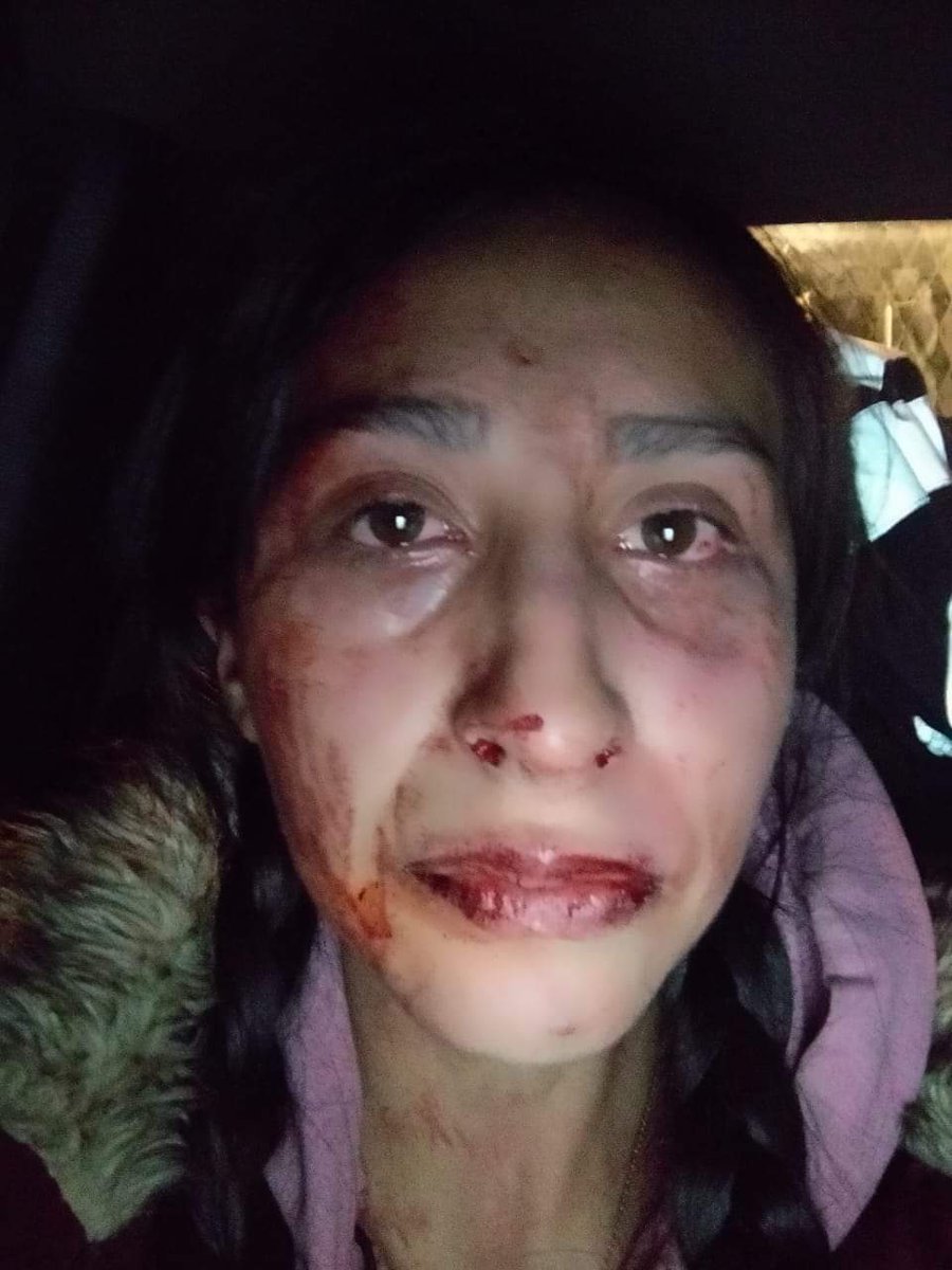 Osiris___Ksb89's tweet image. #policias en estado de ebriedad agredieron verbalmente a los #repartidores de #Rappi al ver que una chica estaba grabando, estos se fueron a agresiones físicas empezando con ella, esto en Barranca del muerto #139 #CDMX apoyen #Compartiendo exigimos justicia @JerrxG1