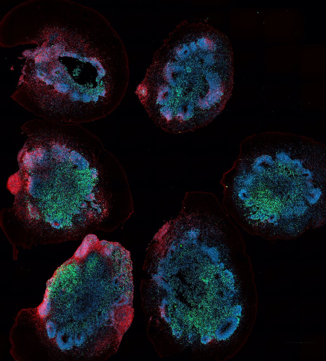 Very excited that @nhmrc provided us #ideas grant to dissect the mechanism of #flavivirus pathogenesis in human brain. As such @KhromykhAlex's lab is now hiring. We are looking for a postdoc, RA, and a PhD student to work on two research projects.