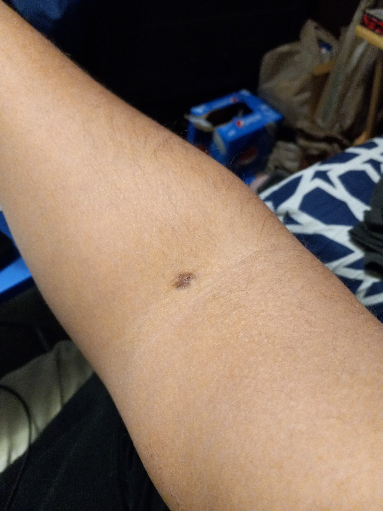 Mazin-Cody on X: "@ironmouse It's always great to donate plasma, I have  been doing it for over 6-7 years (maybe 8). And to make ot better, i am O-,  a Universal donor