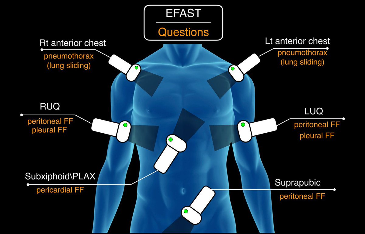 "eFAST"

ultrasonographic protocol designed to detect peritoneal fluid, pericardial fluid, unexplained hypotension and hemothorax/pneumothorax in a trauma patient. 

عملت على شرح مبسّط ان شاء الله يفيدكم.