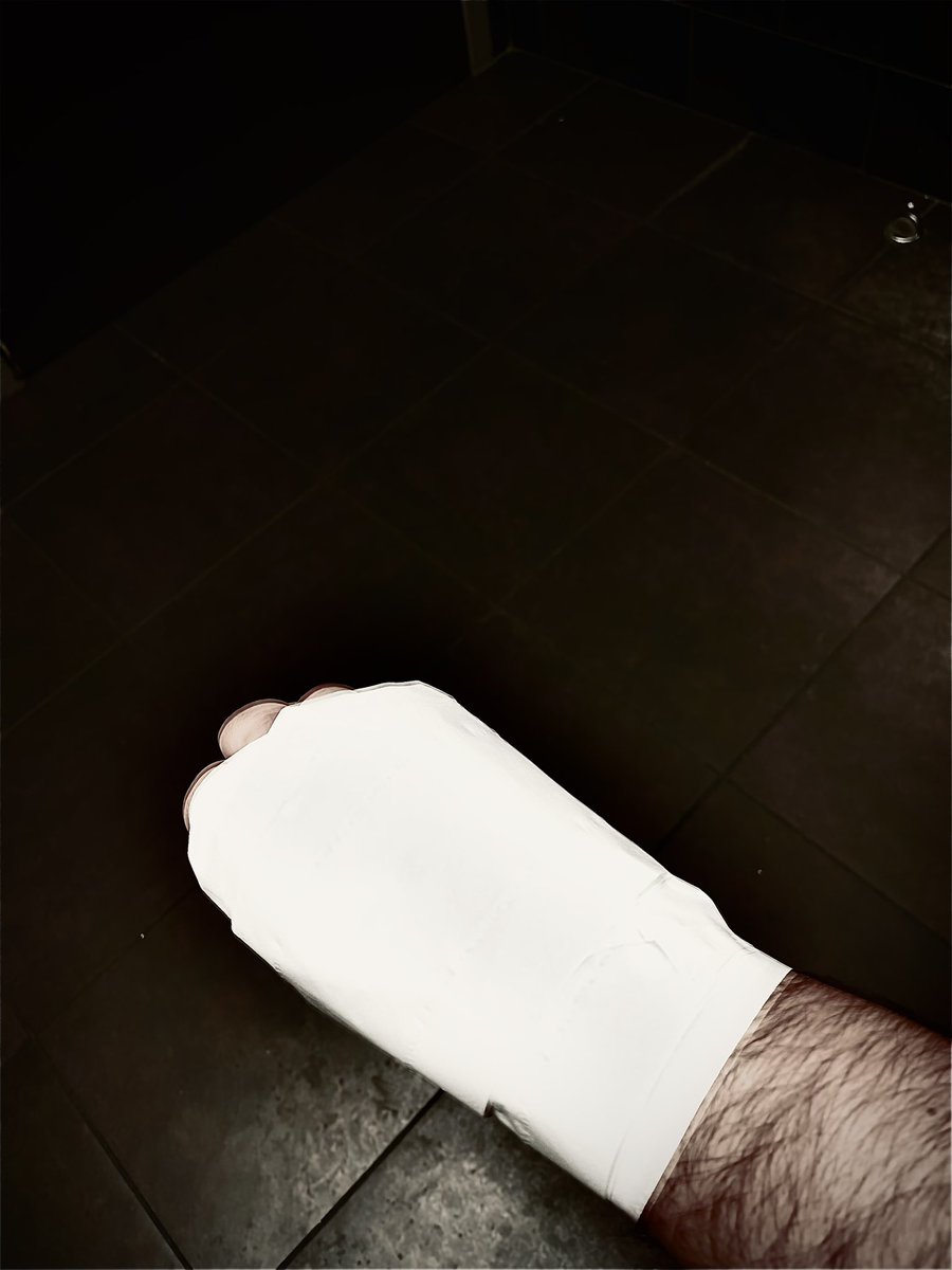 Shit happens…battles test and harden, they define you. A brick to the hand, the cast hadn’t even set and dried. No matter. Mission accomplished and that cancerous weasly punk gone and off to the hospital and a tedious road to living even a normal life…Fuck with me, find out.