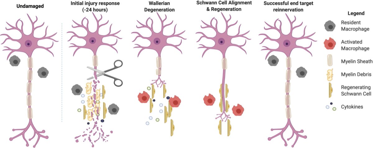BOrmseth's tweet photo. Visual highlighting the different stages of #peripheralnerve repair following injury https://t.co/RCxOU6reWW