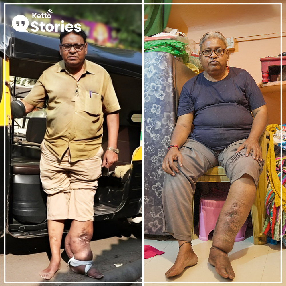 ketto's tweet photo. #KettoStories #UsingInternetForGood
"I was battling Elephantiasis & discrimination for over a decade, but I underwent treatment thanks to you! I can now drive my auto around the city & care for my adopted dogs and cats." -Prakash Niwdunge
Read more at: https://t.co/boGGoowmee https://t.co/tUBxWQmpKf