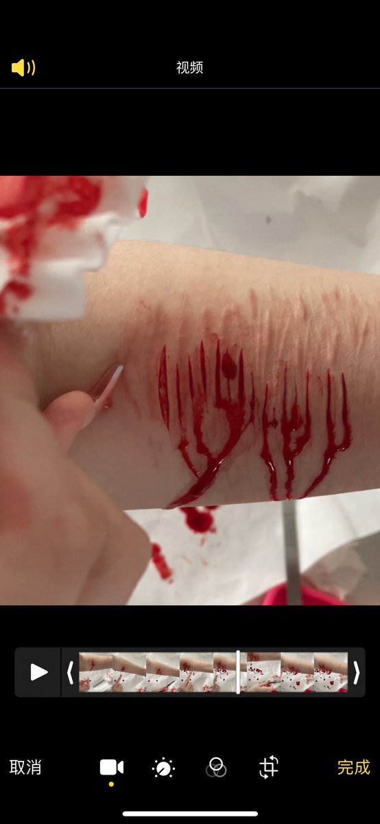 touchassfish_'s tweet photo. #selfharm https://t.co/NZsHOR6Q22