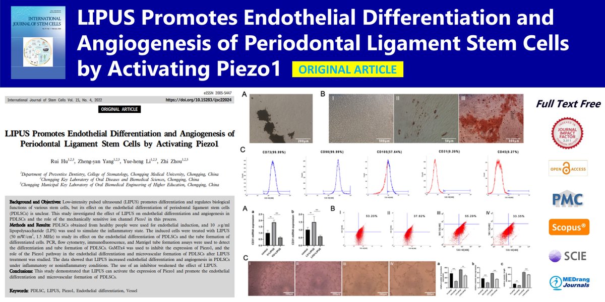 IntJStemCells's tweet photo. LIPUS Promotes Endothelial Differentiation and Angiogenesis of Periodontal Ligament Stem Cells by Activating Piezo1
🌷https://t.co/1SVcbSD6K4 
International Journal of Stem Cells 2022;15(4)Rui Hu
#PDLSC #LIPUS #Piezo1 
#Endothelial_differentiation #Vessel https://t.co/qooRdxr21y