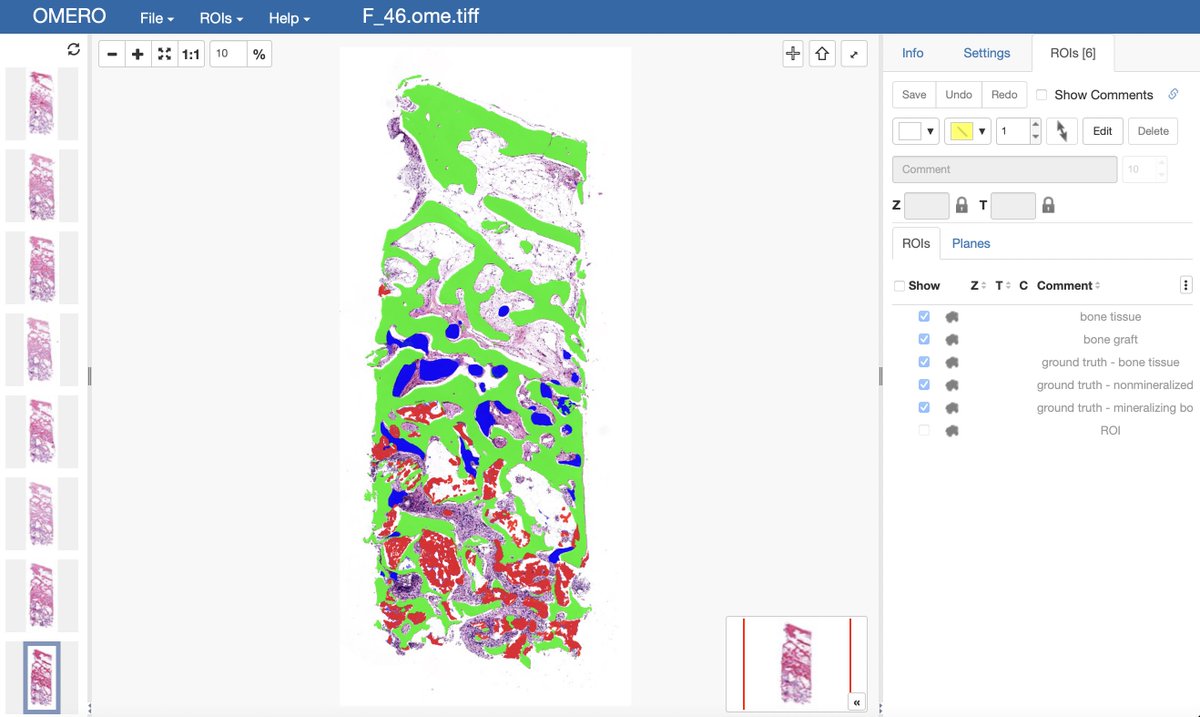 IDRnews's tweet photo. IDR releases a new study ahead of its publication - Reconstructing 3D histological structures using machine learning (AI) algorithms by Baskay et al.
https://t.co/ooU2419r5O https://t.co/t7s8dyTucn