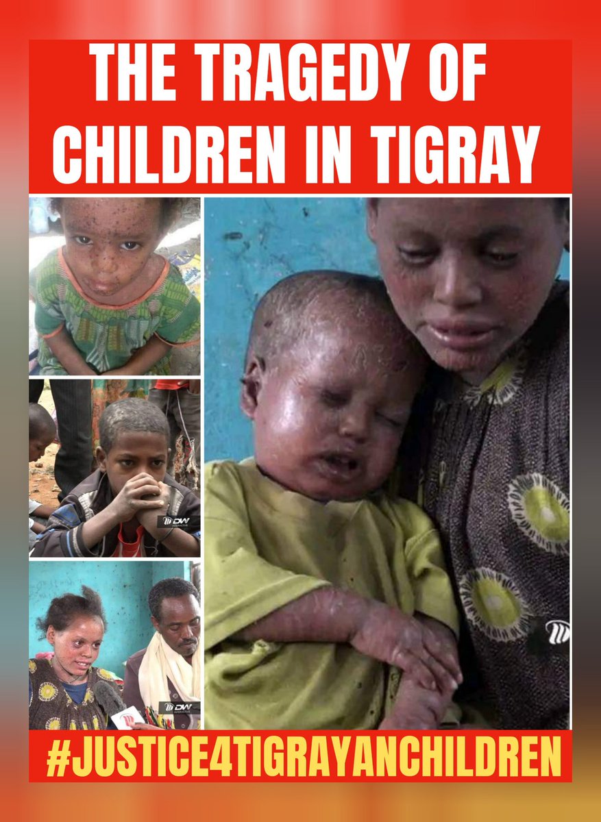 menbert_'s tweet photo. Children of Tigray are suffering as such, I think no one  can imagine this would happen in the 21 century. Unfortunately, this is happening in Tigray.😭
Children are suffering from malnutrition and lack of medical treatment.
#DeclareTigrayFamine
@WFP @USAID @ICRC
M.r# https://t.co/dOWV7upJSQ