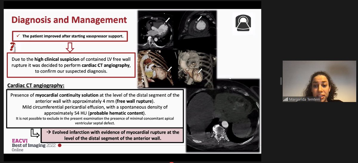MSBBrandao's tweet photo. Outstanding clinical case presentation by @TemtemMargarida in #EACVIBestOf2022 👏👏 https://t.co/ZyCzbtoI3U