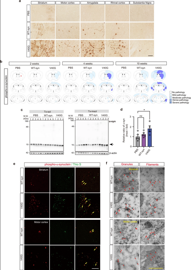 The Science of Parkinson's tweet media