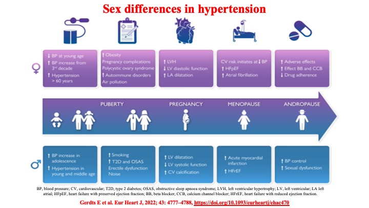 📌 Sex differences in hypertension
#bloodpressure #Medtwitter #CardioTwitter #WomenHeartHealth @AnastasiaSMihai @DBelardoMD @DrMarthaGulati @purviparwani @ErinMichos @SeguraCardio @Hragy @cpgale3 @ShelleyZieroth @iamritu @CarinaHardy4 @JagSinghMD @JonPicciniSr @AskDrShashank