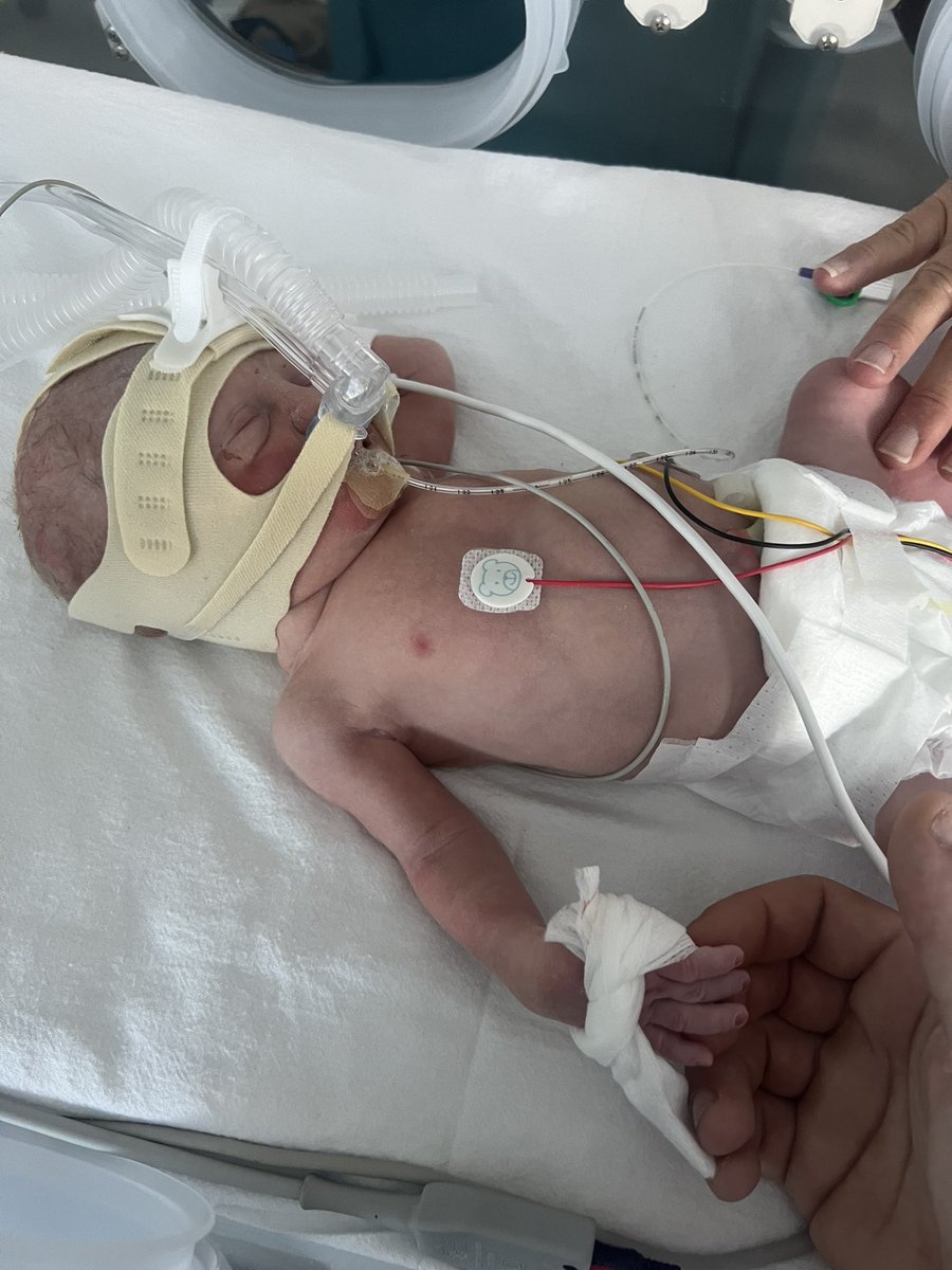 Please welcome to worlds youngest west ham fan… my first baby! My son. Koby Robert Thomas! <a href="/WestHam/">West Ham United</a> <a href="/_DeclanRice/">Declan Rice</a> <a href="/Michailantonio/">Michail Antonio</a> <a href="/_JarrodBowen/">Jarrod Bowen</a> <a href="/manulanzini/">Manuel Lanzini</a> <a href="/pablofornals/">Pablo Fornals</a> <a href="/KurtZouma/">Kurt Zouma</a> <a href="/LukaszFabianski/">Łukasz Fabiański</a> <a href="/Aaron_Cresswell/">AARON CRESSWELL</a>