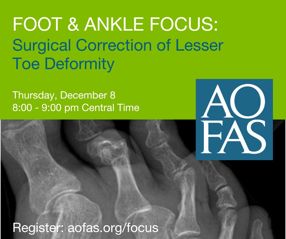 It’s not too late to register for tonight’s Foot &amp; Ankle Focus covering minimally invasive surgery, plantar plate repair, and open surgery with toe pinning for the lesser toes. aofas.org/focus