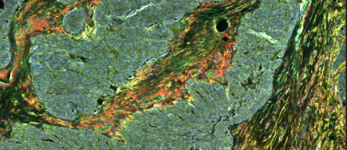 Cancer Cell Invasion lab tweet media