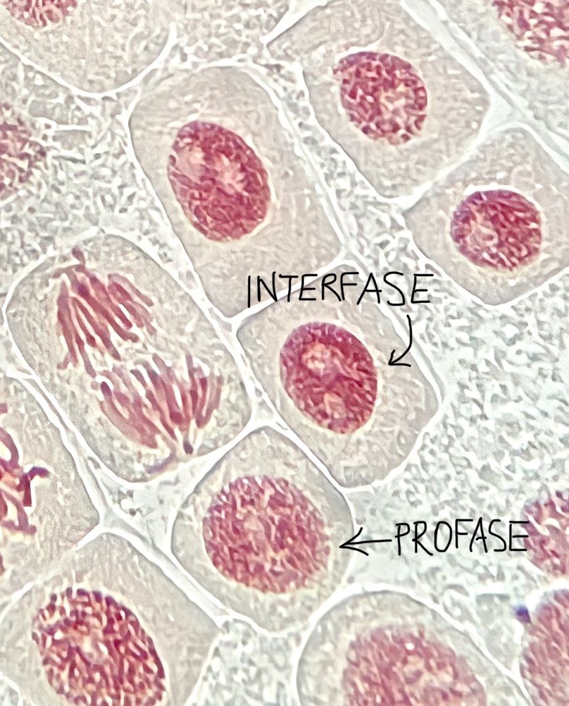 anareysaez's tweet photo. Ana Rey
#practicamitosis #BCGBMedicinaUAM22_23 #lamejorinterfasevsprofase @VegaGEscudero https://t.co/qm4yyZ3W2M