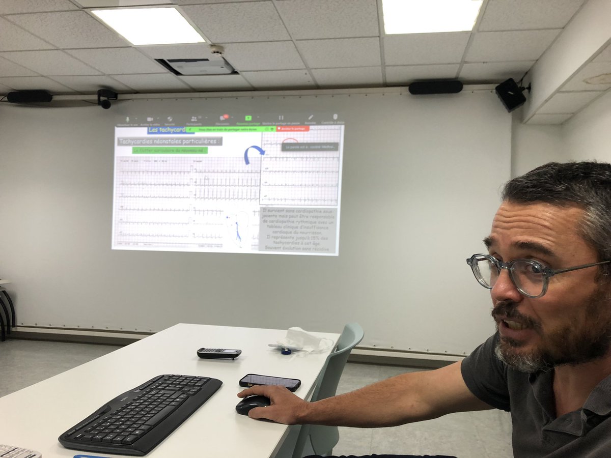 👍 60 participants pour la session DPC sur l’ECG de l’enfant de la <a href="/sf_pediatrie/">Société Française de Pédiatrie</a> avec Dr Nicolas Combes <a href="/cliniquepasteur/">Clinique PASTEUR Toulouse</a> <a href="/CHUBordeaux/">CHU de Bordeaux</a> <a href="/ihu_liryc/">IHU Liryc</a> <a href="/fondationbxuniv/">Fondation Bordeaux Université</a>