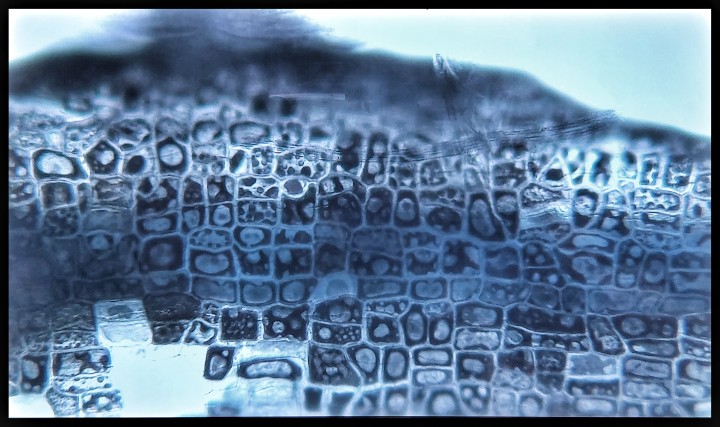 Soil Biology Group - WUR (@sbl_wur) on Twitter photo This morning one of our students found this 'Klimt' painting in a microscope slide of a plant root. Just an unexpected treasure when researching AMF fungi in root cells! <a href="/vangoghmuseum/">Van Gogh Museum</a> This morning one of our students found this 'Klimt' painting in a microscope slide of a plant root. Just an unexpected treasure when researching AMF fungi in root cells! <a href="/vangoghmuseum/">Van Gogh Museum</a>