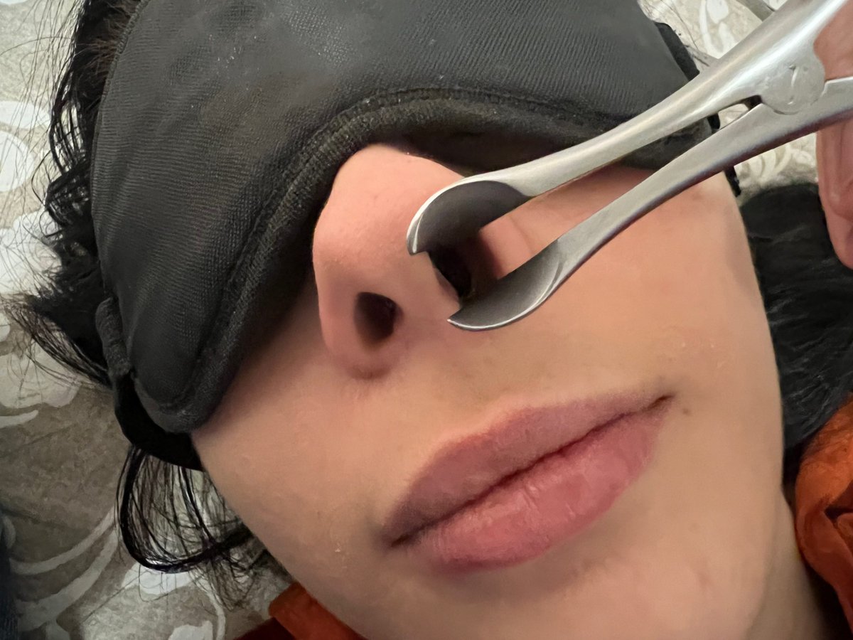 NoseFetNet's tweet photo. New #miss Miss Rotterdam posted on NoseFet - https://t.co/LLmTuZ110o Vote if you want more contents with miss Rotterdam nostrils #Blinded #Girl #Hotnews #Medfet #Pig #Speculum #Submissive https://t.co/mf2eP6iFRI