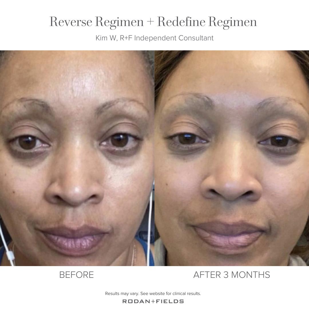 RodanFieldsHQ's tweet image. Step-by-step Multi-Med Therapy makes sure your skin gets the right dose of ingredients at the right time for the best results.

Kim used our Reverse Regimen + Redefine Regimen and is glowing! 🤩 

#BeforeAftersRF #ReverseRegimen #RedefineRegimen