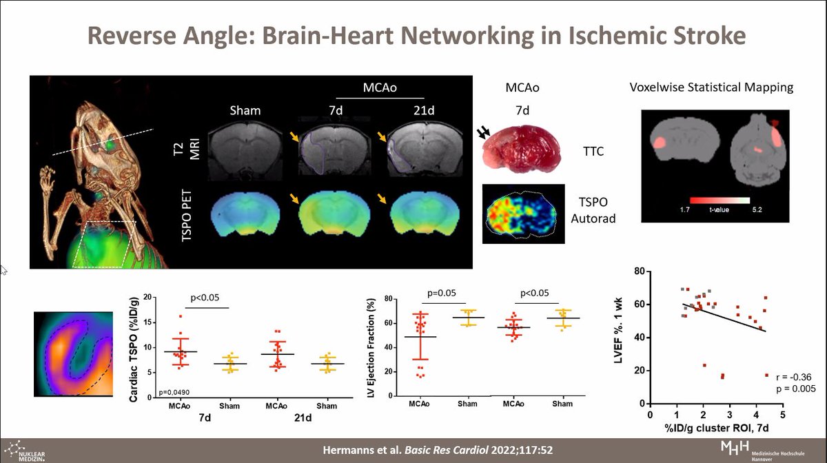 Sharmila Dorbala (@dorbalasharmila) on Twitter photo Amazing <a href="/BWHCVimaging/">Brigham and Women’s Cardiovascular Imaging Program</a> grand rounds by Dr. Frank Bengel. The future role of #CVmolecularimaging is bright. Imaging post MI inflammation and heart brain connections emerging. The insular cortex links cardiovascular function in primary brain injury <a href="/MyASNC/">ASNC Society</a> <a href="/SNM_MI/">SNMMI</a> Amazing <a href="/BWHCVimaging/">Brigham and Women’s Cardiovascular Imaging Program</a> grand rounds by Dr. Frank Bengel. The future role of #CVmolecularimaging is bright. Imaging post MI inflammation and heart brain connections emerging. The insular cortex links cardiovascular function in primary brain injury <a href="/MyASNC/">ASNC Society</a> <a href="/SNM_MI/">SNMMI</a>