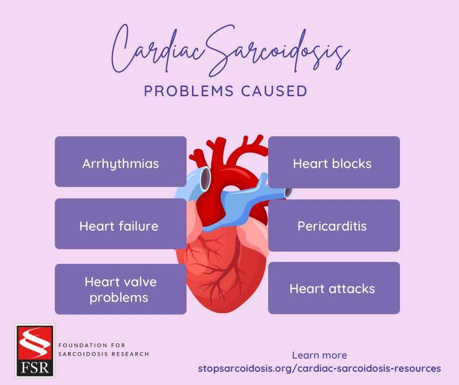 Cardiac sarcoidosis affects more than 10% of people with #sarcoidosis in the United States, and perhaps as many as 25%. Because heart problems can be very serious, everyone who has sarcoidosis should be screened for cardiac sarcoidosis.

Learn more: loom.ly/hpq0iQA