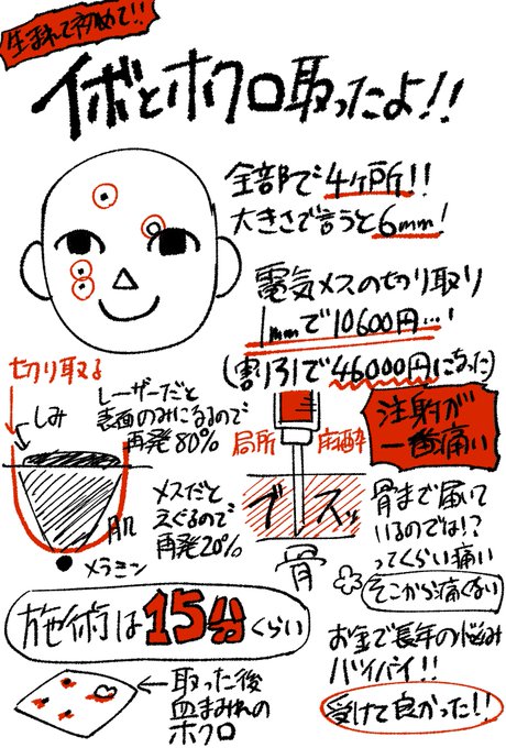 昨日初めて美容外科に行って、
イボとホクロ取ってきました!
自分のコンプレックスをお金で解決できるなら
行く価値ありだと思いました。
施術自体は短かったけど、
カウンセリングに2時間半かかったので、
時間が取れる休日に行くのおすすめです!
取ってよかったー! 