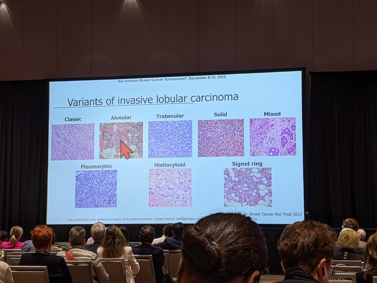 Thrilled to see #SABCS2022 dig into histologic special types of #breastcancer like #nolumplobular. Great presentation by the one and only Dr. Jorge Reis-Filho. #lobmob <a href="/LobularBCA/">Lobular Breast Cancer Alliance</a>