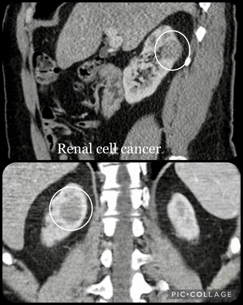 𝙍𝙖𝙠𝙚𝙨𝙝 𝙎. 𝘼𝙝𝙪𝙟𝙖, 𝙈𝘿 tweet media