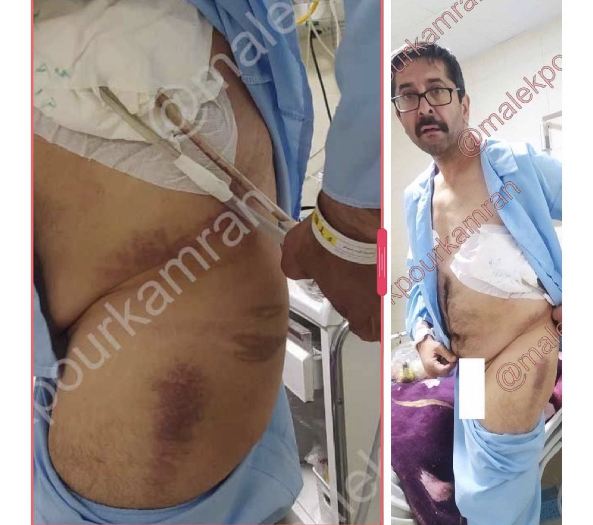 SanaELedene's tweet photo. Please please help us to stop death threats. #HamidGharehHasanlou is a father of two. He has done so many charity works. He is a doctor and an influential part of the society like all of these people in jail. Please share this as much as you can.
#IranRevolution
#MohsenShekari https://t.co/qmLBFt7Tlq