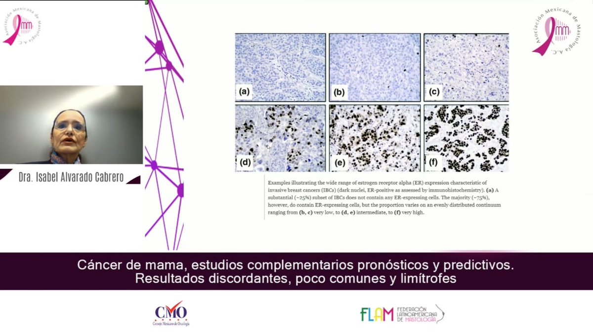 MastologiaMx's tweet image. Así vivimos la última #MasterClass2022
Contamos con la participación de excelentes ponentes, la Dra. Nina Ríos y la Dra. Isabel Alvarado,ambas líderes de opinión médica. 
Gracias a todos los asistentes virtuales por acompañarnos en los eventos académicos
#EnEquipoLoHacemosMejor
