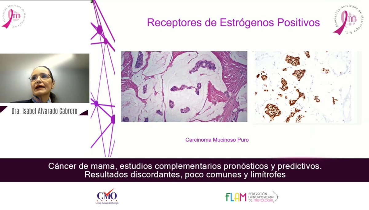 MastologiaMx's tweet image. Así vivimos la última #MasterClass2022
Contamos con la participación de excelentes ponentes, la Dra. Nina Ríos y la Dra. Isabel Alvarado,ambas líderes de opinión médica. 
Gracias a todos los asistentes virtuales por acompañarnos en los eventos académicos
#EnEquipoLoHacemosMejor