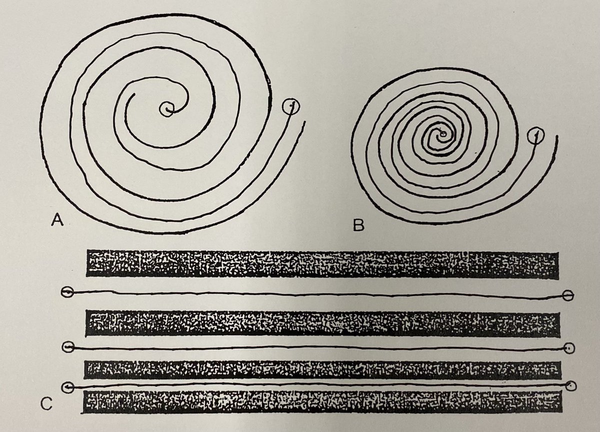 Today we treated the 19th patient of our bilateral #MRgFUS trial. Look at her spirals just 1 hour after the procedure. Before the surgery, she was not able to put pen to paper, literally. @DrAlfonsoFasano @INSIGHTEC @FUSFoundation 

…mentdisorders.onlinelibrary.wiley.com/doi/10.1002/md…