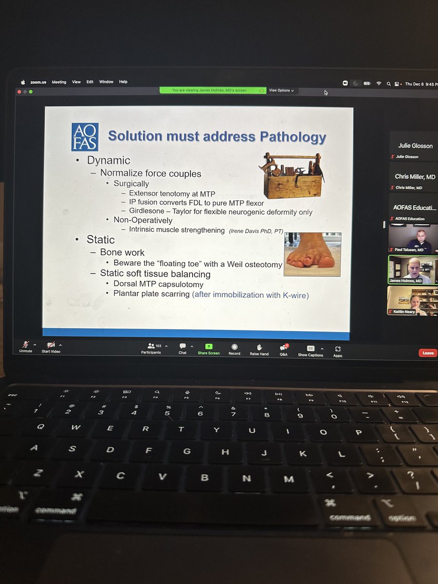 Happening now! <a href="/AOFAS/">AOFAS</a> Lesser toe correction webinar. 

Awesome talks by copanelists Dr. Kaitlin Neary, James Holmes and ⁦<a href="/PaulTalusan_MD/">Paul Talusan MD</a>⁩

Honored to be on the panel myself talking on #MIS⁩ ⁦<a href="/Ortho_BIDMC/">Ortho_BIDMC</a>⁩ #orthotwitter