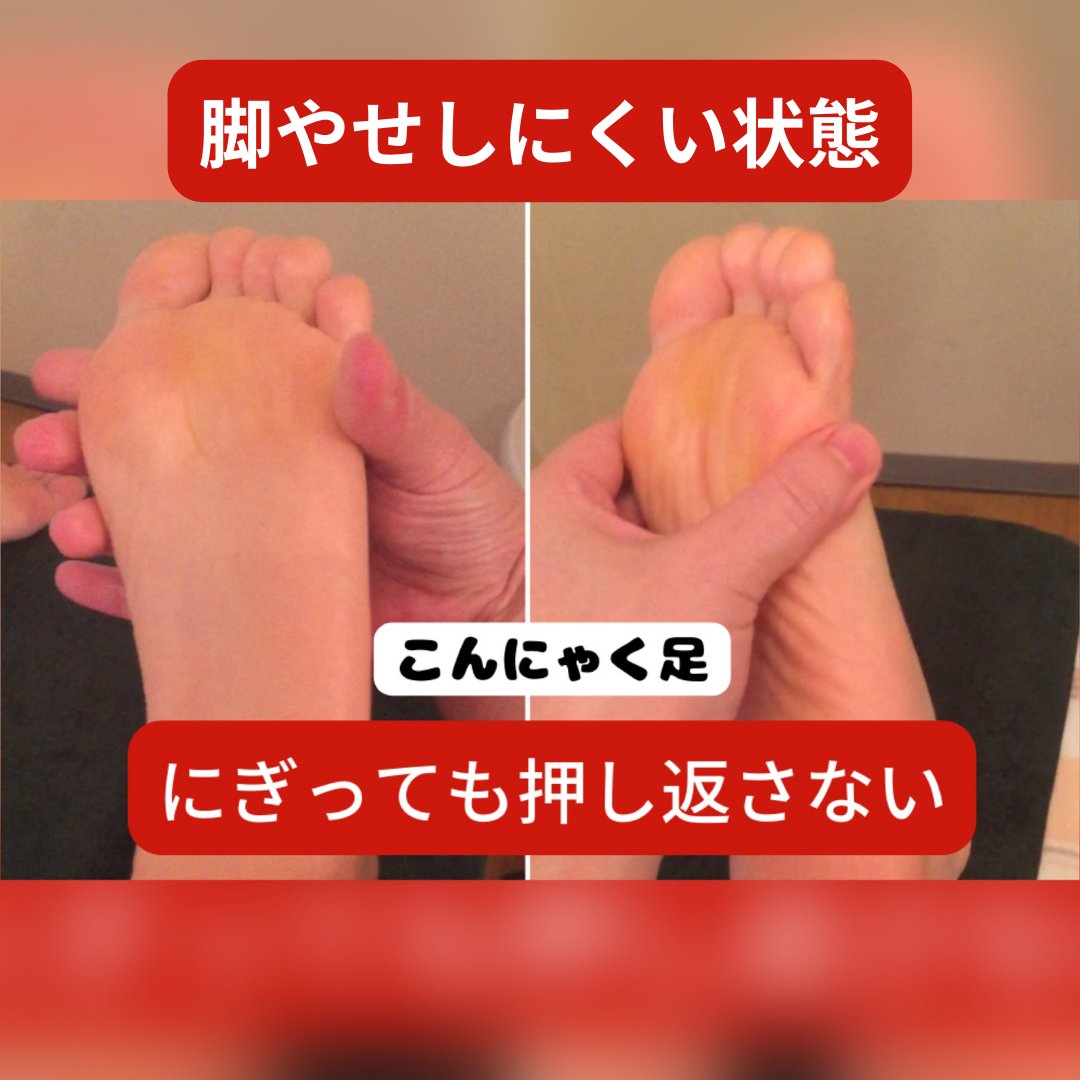 infotakako's tweet photo. こんにゃく足って聞いたことあります？
https://t.co/T6M9f6sunD
#こんにゃく足
#脚やせ
#脚やせエステ二十三夜 https://t.co/d1dINNdaCa