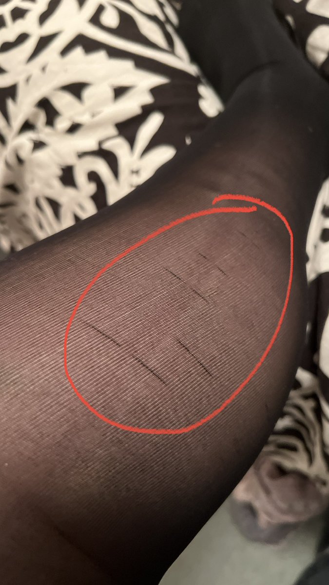 lesleykblake's tweet photo. A friendly reminder to always read the fine print. @SheertexLabs tights are overpriced, pieces of trash and surprise surprise - they don’t offer refunds or returns. This was directly out of the package. So much for snag free. I’ll stick with my $10 @Target tights. #sheertex #scam https://t.co/4VhqnQTdtf