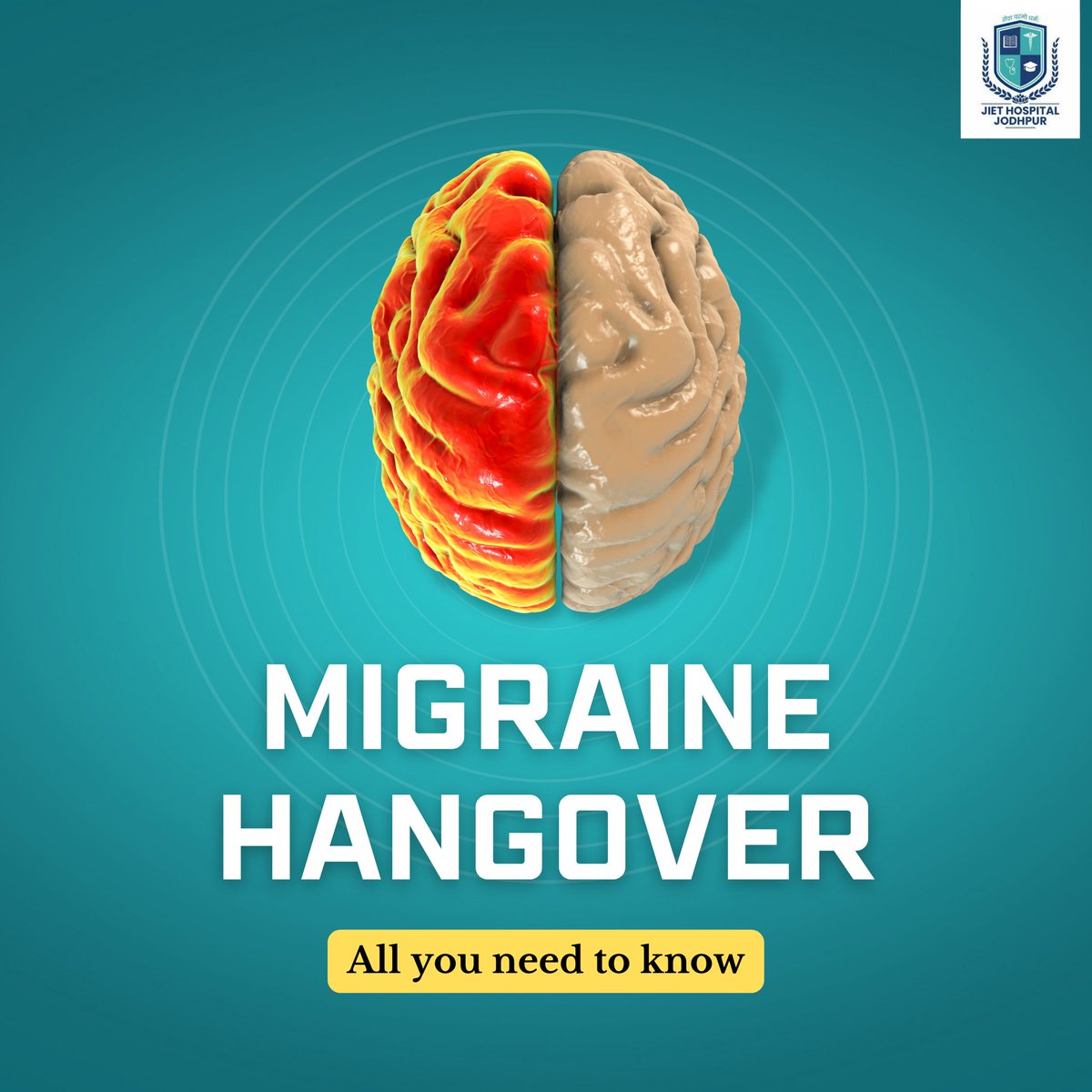 JietHospital's tweet photo. A #migraine hangover is not alcohol-induced but rather an attack that mimics the symptoms of a basic hangover.
Migraine hangover, medically referred to as #postdrome, is the last stage of a migraine #attack, which may last for hours or even days before fully subsiding. https://t.co/PLAqNV5wjO