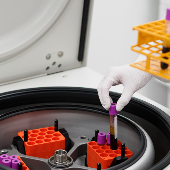 The year is coming to an end and it's time to see which biobank researches Auria Biobank was involved in this year
auria.fi/biopankki/en/b…
#Researcher #biobank #biopankki @TyksVsshp  <a href="/FinbbSuomi/">Finnish Biobanks – FINBB</a>  #hoito <a href="/SuomenBiopankit/">Suomen Biopankit</a>  #biopankkisuostumus #TuenTiedettä #ParannammeJokaPäivä