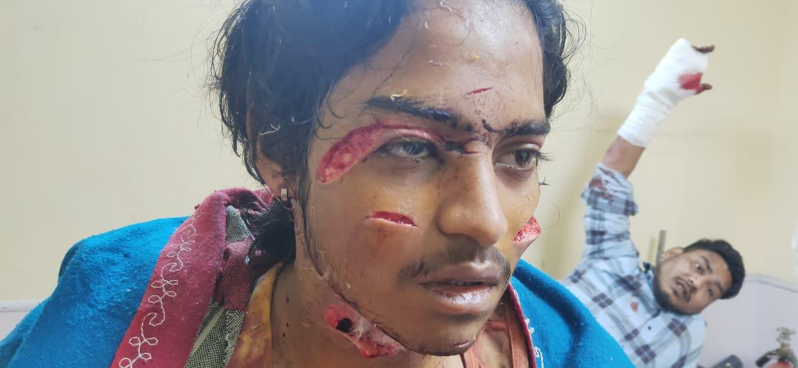 जिहाद रोकना है तो

पुलिस और ज्यूडिशियल रिफार्म करिए

विशेष कानून विशेष दर्जा विशेष स्कूल व विदेशी फंडिंग बंद करिए

घुसपैठ घूसखोरी कालाधान हवाला धर्मांतरण और नशा तस्करी के खिलाफ कठोर कानून बनाइए

समान शिक्षा समान नागरिक संहिता समान धर्मस्थल संहिता और समान जनसंख्या संहिता लागू करिए