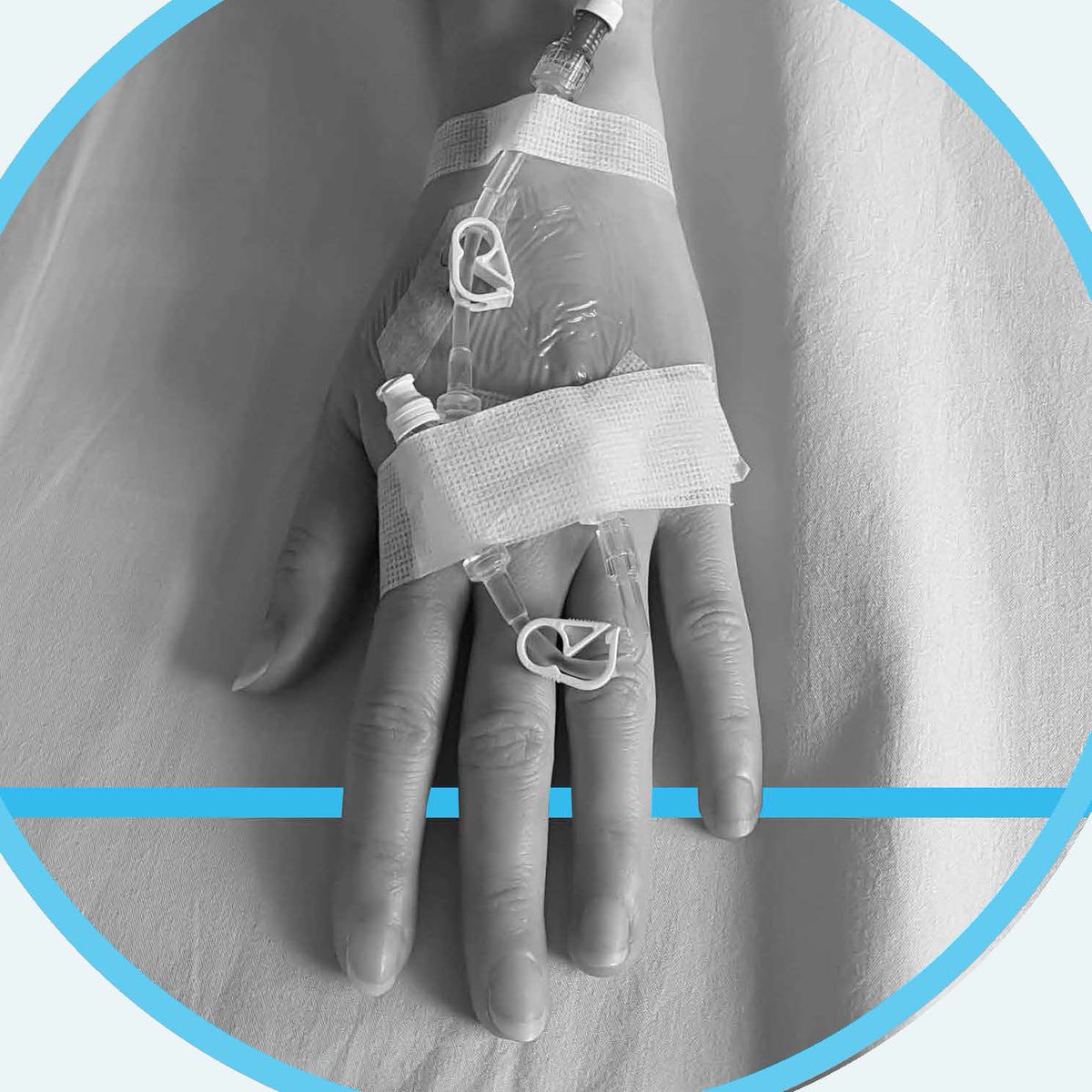 NHSResolution's tweet photo. Our latest Did You Know leaflet from our #SafetyAndLearning team is focused on learnings from #Extravasation claims.
Read more about the newly published extravasation leaflet on our website -> https://t.co/MbUPgJneR5
#LearningFromClaims #PatientSafety #MedicationErrors https://t.co/1bQ9icCvSs