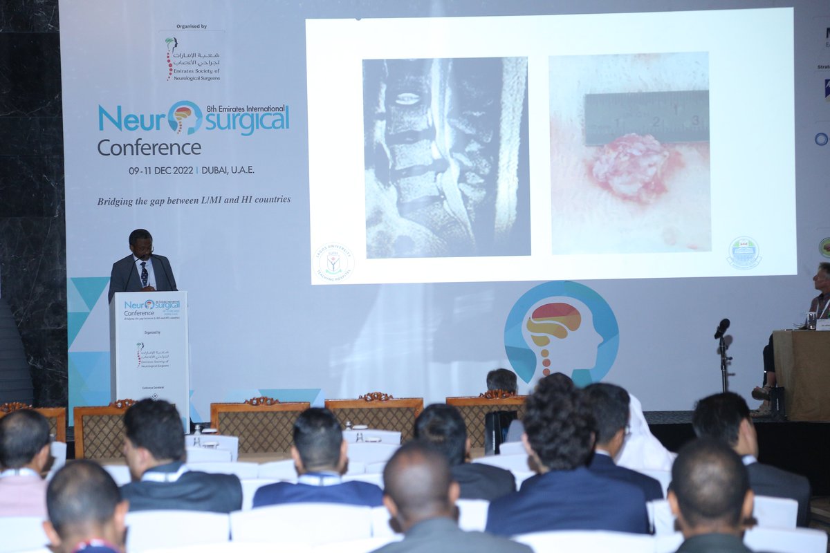 EINC2022's tweet image. Dr. Omotayo Abimbola Ojo Lecture &quot;Quality Neurosurgery Care in Resource-Poor Regions Despite the Challenges&quot; at #EINC2022

Dr. Omotayo&apos;s Session shed light on the difficulties and challenges in providing quality neurosurgery care to regions with poor resources.