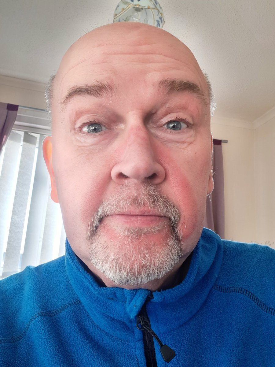 ImDJRich's tweet photo. Just had a shave. 
You really can't tell where my CPAP mask has been,can you? https://t.co/ttEj8rvzGZ