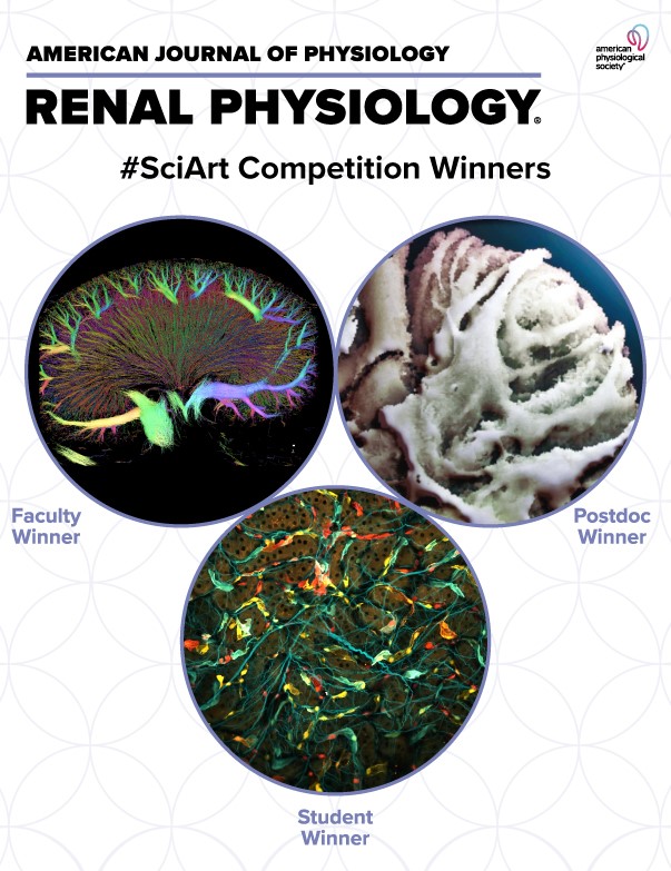 AJP Renal (@ajprenal) on Twitter photo Check out #AJPRenal's December issue cover! Congratulations to our Clash of the Kidneys: #SciArt Competition winners!!
<a href="/bohovyk/">Ruslan Bohovyk</a> <a href="/USouthFlorida/">University of South Florida</a> <a href="/Ina_M_Schiessl/">Ina Maria Schiessl</a> <a href="/AarhusUni/">Aarhus Universitet</a> @BiomedUCPH <a href="/ERC_Research/">European Research Council (ERC)</a>
<a href="/DTU_Ultrasound/">Center for Fast Ultrasound Imaging</a> <a href="/CharlotteMehlin/">Charlotte Mehlin Sørensen</a>
#Kidney Check out #AJPRenal's December issue cover! Congratulations to our Clash of the Kidneys: #SciArt Competition winners!!
<a href="/bohovyk/">Ruslan Bohovyk</a> <a href="/USouthFlorida/">University of South Florida</a> <a href="/Ina_M_Schiessl/">Ina Maria Schiessl</a> <a href="/AarhusUni/">Aarhus Universitet</a> @BiomedUCPH <a href="/ERC_Research/">European Research Council (ERC)</a>
<a href="/DTU_Ultrasound/">Center for Fast Ultrasound Imaging</a> <a href="/CharlotteMehlin/">Charlotte Mehlin Sørensen</a>
#Kidney