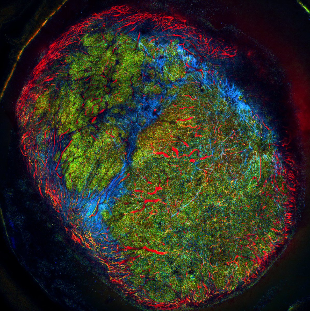 Max Nobis (@max_nobis_) on Twitter photo Celebrating #FluorescenceFriday with the 2nd prize in the in vivo category <a href="/LightMicroAus/">Light Microscopy Aus</a>! 🥂 Capturing: "Metastatic Activity Live and in Colour" <a href="/INCITeCentre/">ACRF INCITe Centre</a>. Many thanks to <a href="/Optiscan_/">Optiscan</a> for sponsoring! Make sure to check out these other awesome entries:
microscopy.org.au/lma-and-via-20… Celebrating #FluorescenceFriday with the 2nd prize in the in vivo category <a href="/LightMicroAus/">Light Microscopy Aus</a>! 🥂 Capturing: "Metastatic Activity Live and in Colour" <a href="/INCITeCentre/">ACRF INCITe Centre</a>. Many thanks to <a href="/Optiscan_/">Optiscan</a> for sponsoring! Make sure to check out these other awesome entries:
microscopy.org.au/lma-and-via-20…