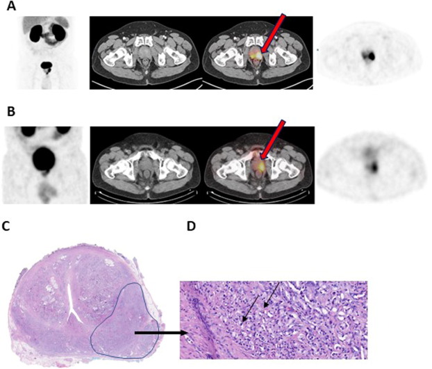 European Urology Oncology tweet media