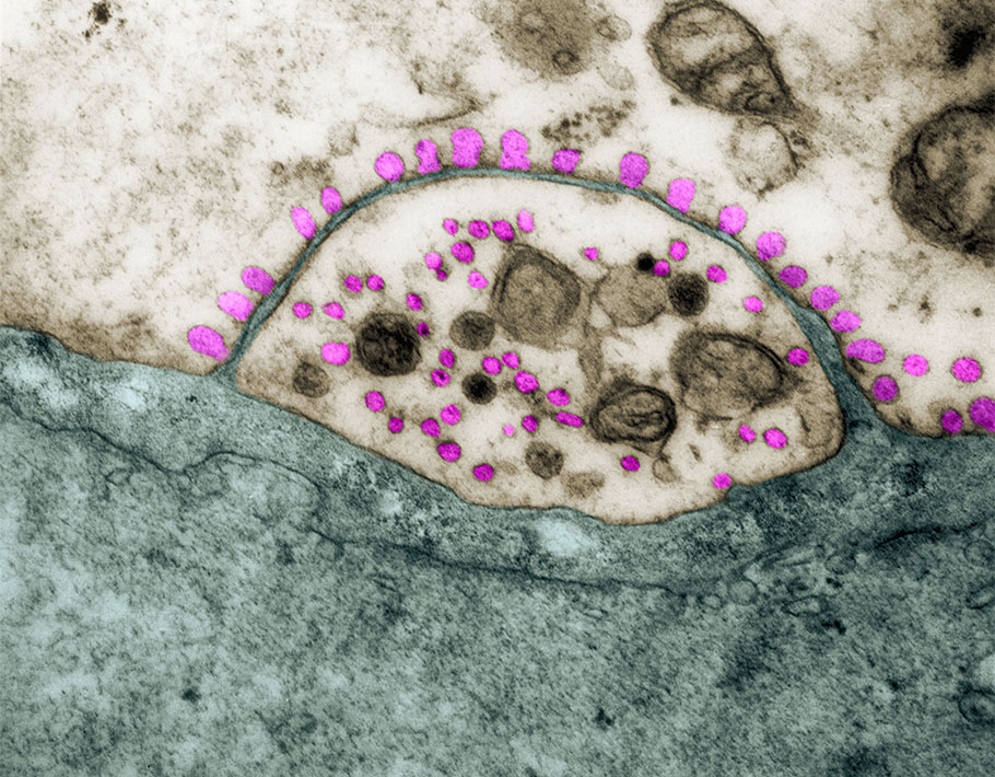 Science Signaling (@scisignal) on Twitter photo Analyzing the fear-conditioned mouse hippocampus, researchers probe patterns in protein #palmitoylation and find the process supports receptor trafficking, dendritic spine formation, and synaptic plasticity. <a href="/GangHippocampus/">Glory Nasseri, MSc</a> <a href="/ShernazBamji/">Shernaz Bamji</a> <a href="/DMCBrainHealth/">Djavad Mowafaghian Centre for Brain Health</a> scim.ag/Ob Analyzing the fear-conditioned mouse hippocampus, researchers probe patterns in protein #palmitoylation and find the process supports receptor trafficking, dendritic spine formation, and synaptic plasticity. <a href="/GangHippocampus/">Glory Nasseri, MSc</a> <a href="/ShernazBamji/">Shernaz Bamji</a> <a href="/DMCBrainHealth/">Djavad Mowafaghian Centre for Brain Health</a> scim.ag/Ob