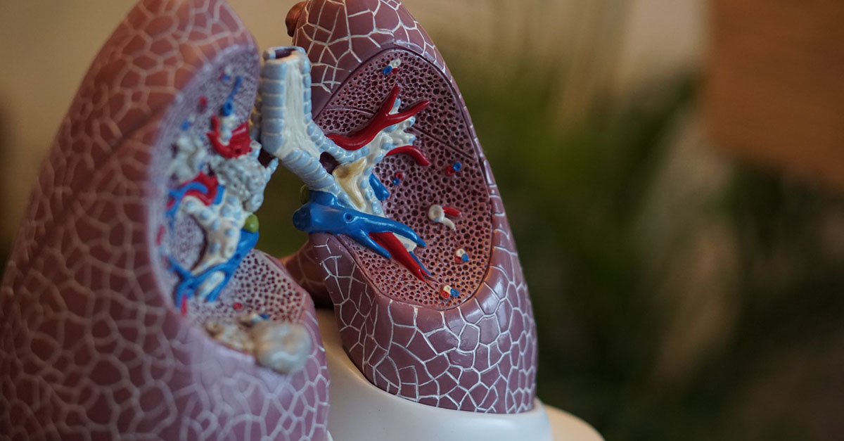 PCRARoadshow's tweet photo. Did you miss the 2022 @PCRSUK live clinical webinars?  

You can now watch @renlawlor and @DrSteveHolmes discuss common problems in asthma on-demand! 🫁

This expert session covers uncontrolled asthma, SABA overuse, and ICS underuse.  

Watch for free: https://t.co/ReaUpXh63a https://t.co/Oy4VCTTIiT