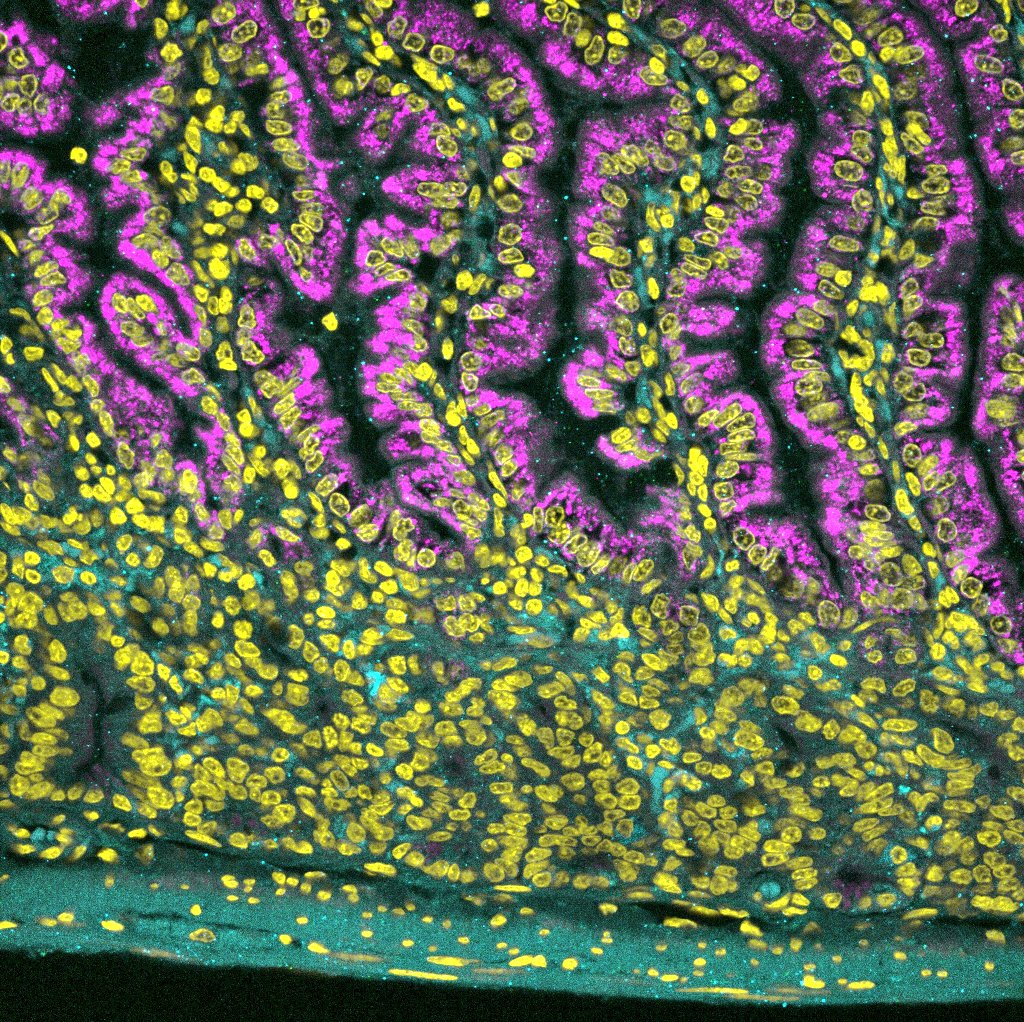 batevodevo's tweet photo. I am in love with my 🦇 #smFISH results showing the small intestinal villi and crypts of a nectar #bat! nuclei in yellow, glucose transporters in pink and cyan @HCRimaging🔬#sciart #bioart #FluorescenceFriday #Microscopy #GITwitter #histophysiology #diet https://t.co/6wSLUafs3U