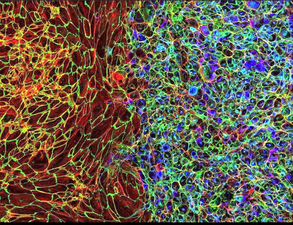 DrAstrocyte's tweet photo. La placenta proporciona nutrientes y oxígeno al bebé y elimina desechos de su sangre. Es una estructura complicada puesto que tiene células de dos organismos: el bebé y la madre. 
A la izquierda el lado materno y a la derecha el lado fetal.
#histología

📸 Immunofluorescence (IG) https://t.co/PP1sCVxggQ