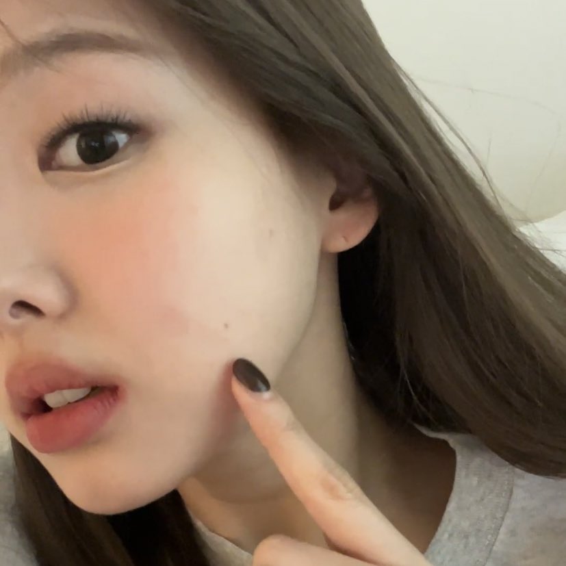 nayeon literally doing a tour on her moles 🥺